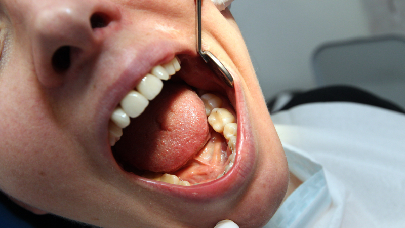 Zobozdravnika bodo skušali privabiti s koncesijo